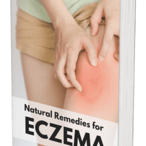 Natural Remedies for Eczema: Your Holistic Guide to Soothing Skin Naturally